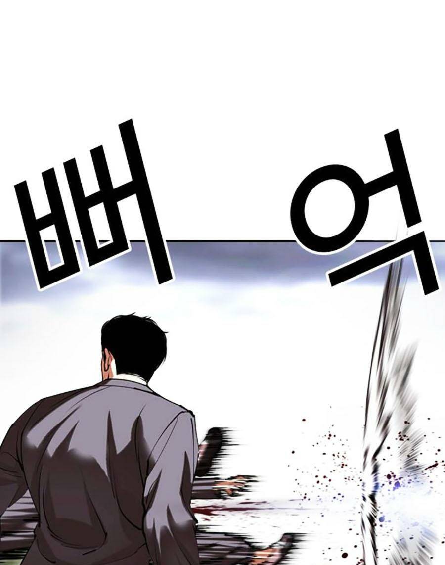 151